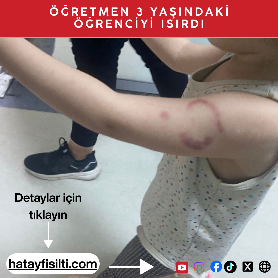 Edirne’de özel bir kreşte, 3 yaşındaki öğrenciyi uyandırmak için ısırdığı iddia edilen öğretmenin görevine son verildi. Öğretmen, savunmasında “Isırmadım, öperken oldu” dedi.